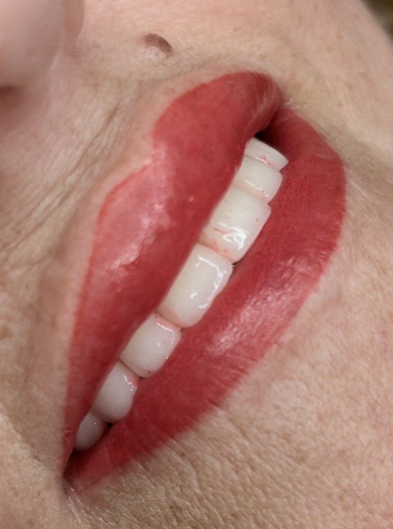 Revitalización de color de labios con micropigmentación en Terrassa